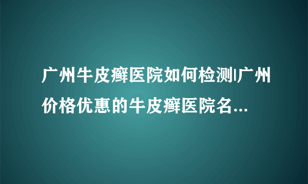 广州牛皮癣医院如何检测|广州价格优惠的牛皮癣医院名单公布-儿童牛皮癣的心理护理