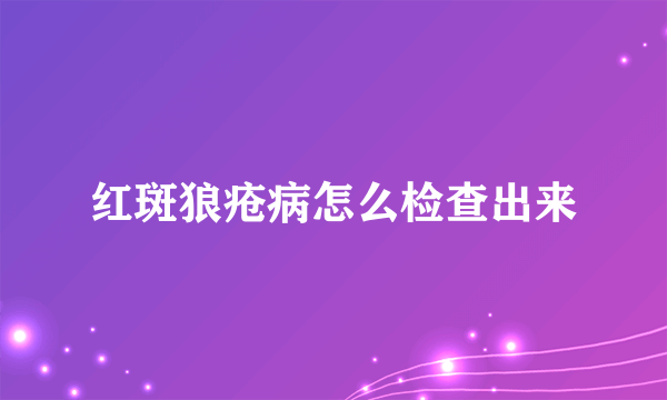 红斑狼疮病怎么检查出来