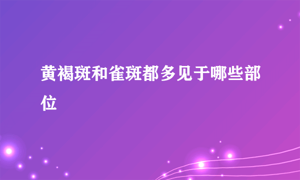 黄褐斑和雀斑都多见于哪些部位