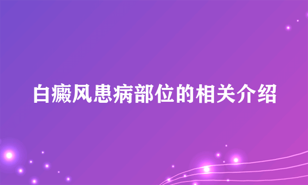 白癜风患病部位的相关介绍