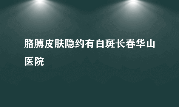 胳膊皮肤隐约有白斑长春华山医院