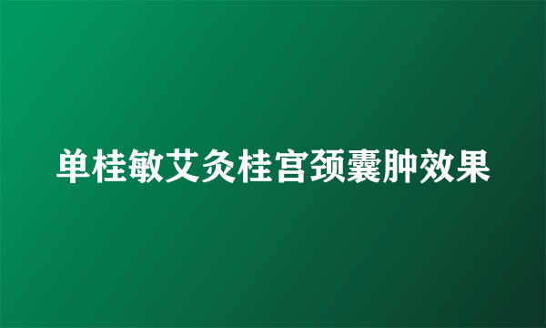 单桂敏艾灸桂宫颈囊肿效果