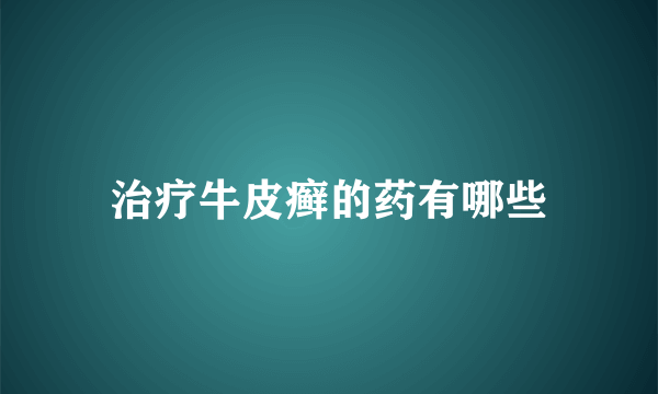 治疗牛皮癣的药有哪些