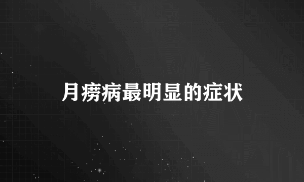 月痨病最明显的症状