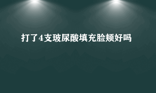 打了4支玻尿酸填充脸颊好吗