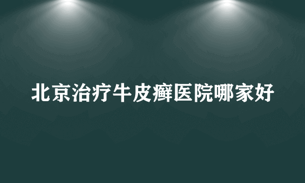 北京治疗牛皮癣医院哪家好