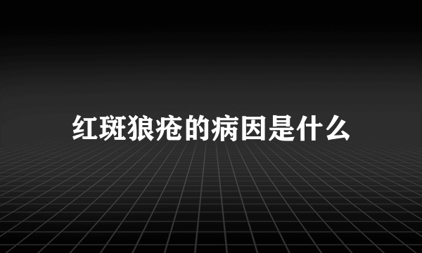 红斑狼疮的病因是什么