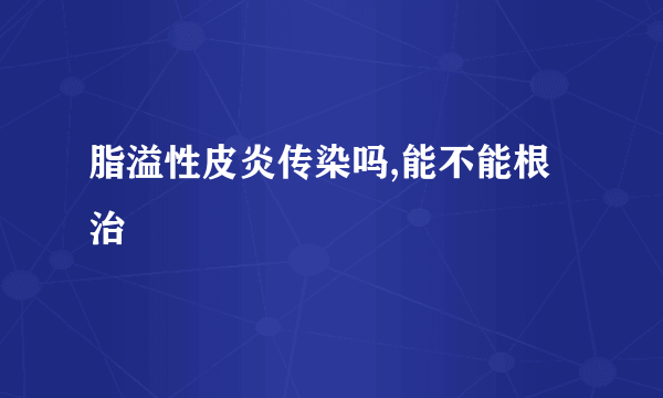 脂溢性皮炎传染吗,能不能根治