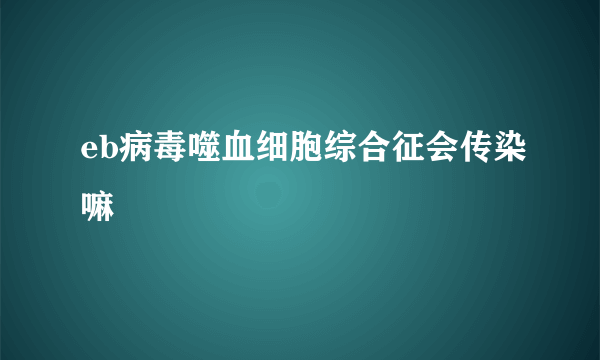 eb病毒噬血细胞综合征会传染嘛