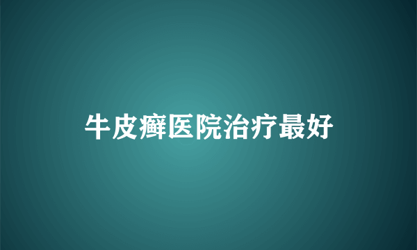 牛皮癣医院治疗最好