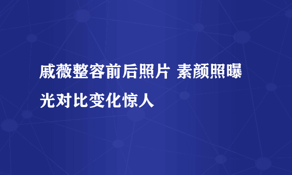 戚薇整容前后照片 素颜照曝光对比变化惊人