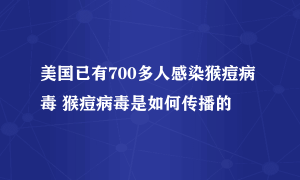 美国已有700多人感染猴痘病毒 猴痘病毒是如何传播的