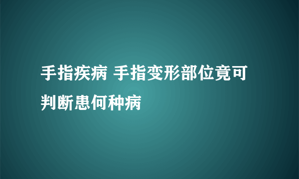 手指疾病 手指变形部位竟可判断患何种病