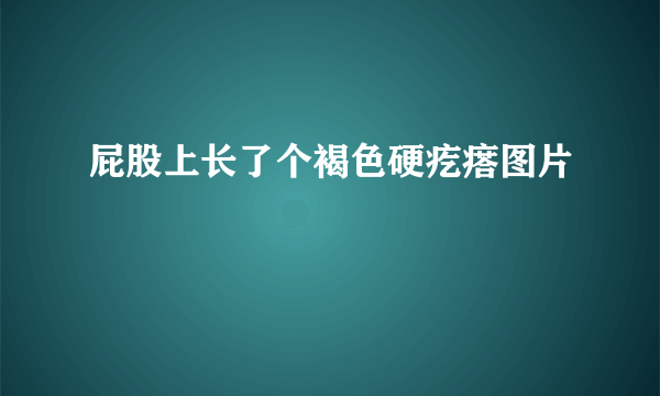 屁股上长了个褐色硬疙瘩图片