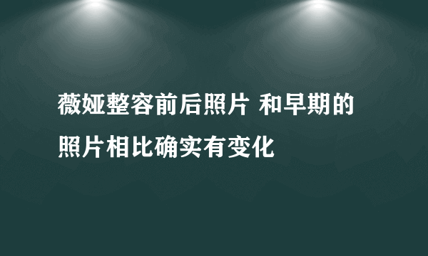 薇娅整容前后照片 和早期的照片相比确实有变化