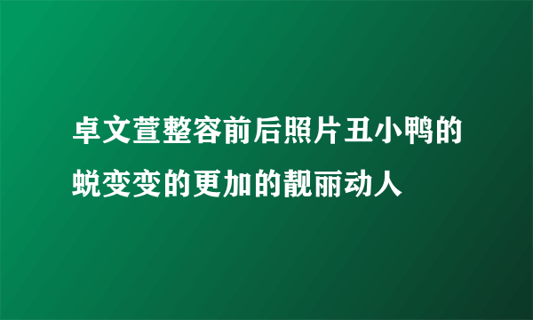 卓文萱整容前后照片丑小鸭的蜕变变的更加的靓丽动人