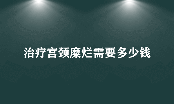 治疗宫颈糜烂需要多少钱