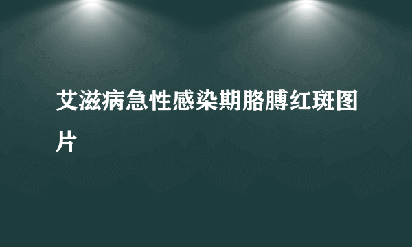 艾滋病急性感染期胳膊红斑图片