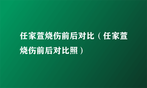 任家萱烧伤前后对比（任家萱烧伤前后对比照）