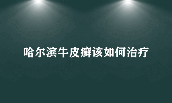 哈尔滨牛皮癣该如何治疗