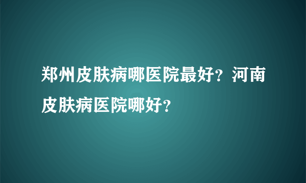 郑州皮肤病哪医院最好？河南皮肤病医院哪好？