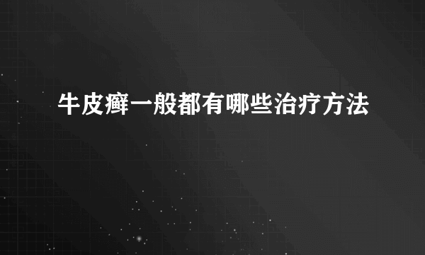 牛皮癣一般都有哪些治疗方法