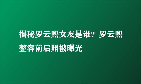 揭秘罗云熙女友是谁？罗云熙整容前后照被曝光