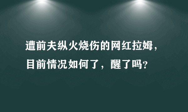 遭前夫纵火烧伤的网红拉姆，目前情况如何了，醒了吗？