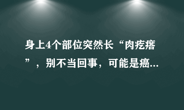 身上4个部位突然长“肉疙瘩”，别不当回事，可能是癌症信号！