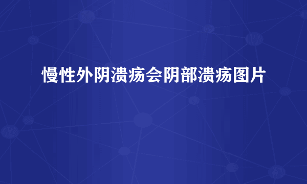 慢性外阴溃疡会阴部溃疡图片