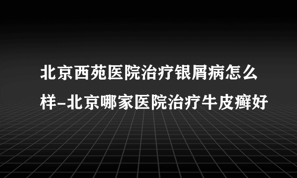 北京西苑医院治疗银屑病怎么样-北京哪家医院治疗牛皮癣好