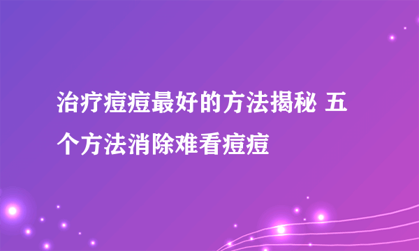 治疗痘痘最好的方法揭秘 五个方法消除难看痘痘