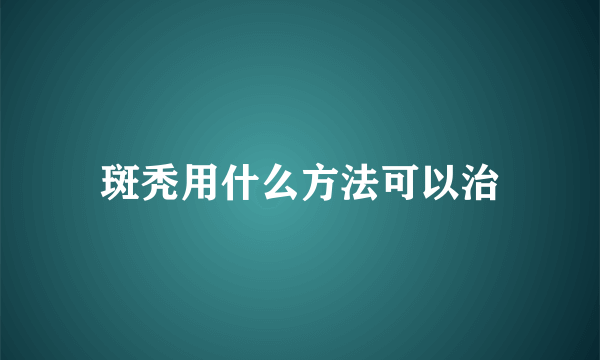 斑秃用什么方法可以治