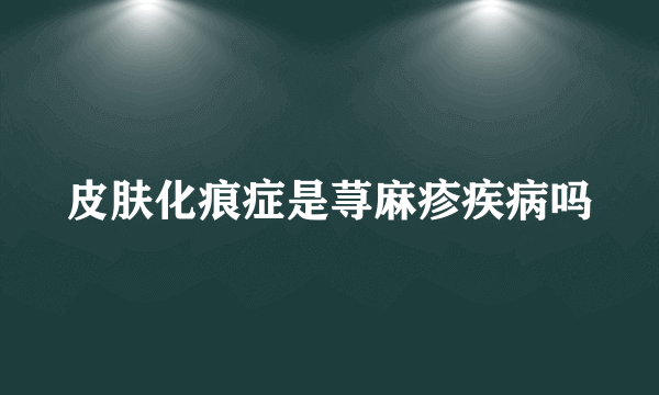 皮肤化痕症是荨麻疹疾病吗