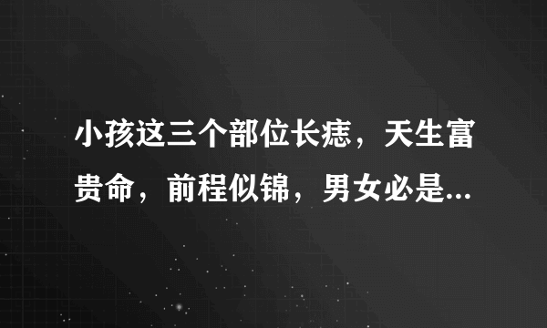 小孩这三个部位长痣，天生富贵命，前程似锦，男女必是人中龙凤！