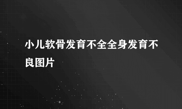 小儿软骨发育不全全身发育不良图片