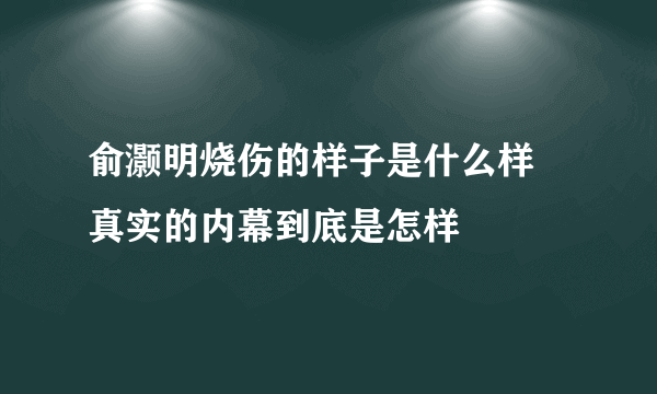 俞灏明烧伤的样子是什么样 真实的内幕到底是怎样