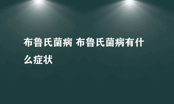 布鲁氏菌病 布鲁氏菌病有什么症状