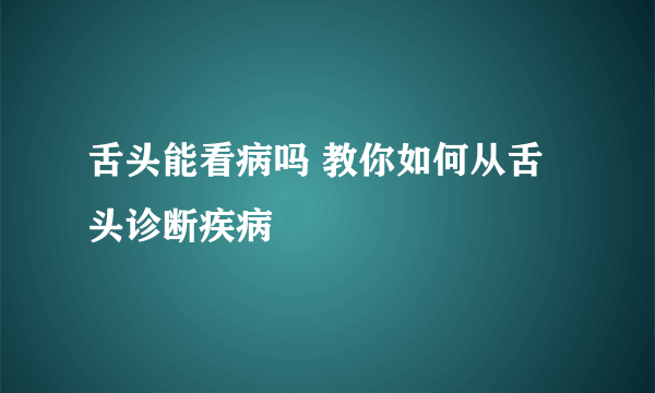 舌头能看病吗 教你如何从舌头诊断疾病