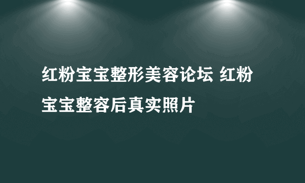 红粉宝宝整形美容论坛 红粉宝宝整容后真实照片