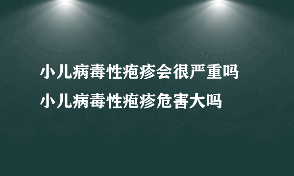 小儿病毒性疱疹会很严重吗 小儿病毒性疱疹危害大吗