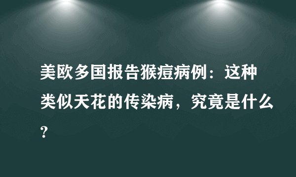 美欧多国报告猴痘病例：这种类似天花的传染病，究竟是什么？