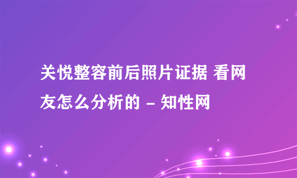 关悦整容前后照片证据 看网友怎么分析的 - 知性网