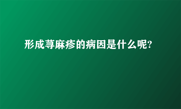 形成荨麻疹的病因是什么呢?