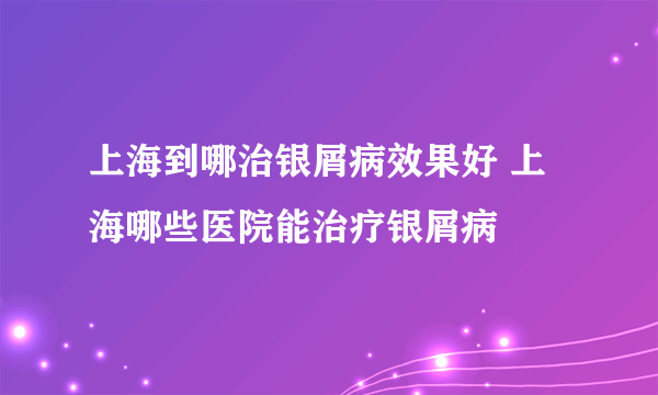 上海到哪治银屑病效果好 上海哪些医院能治疗银屑病