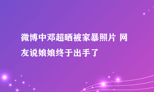 微博中邓超晒被家暴照片 网友说娘娘终于出手了