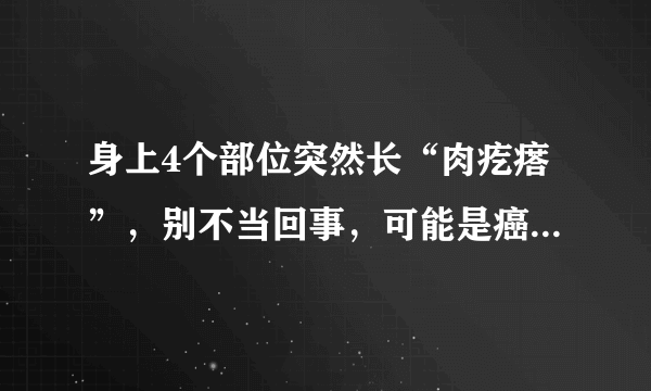 身上4个部位突然长“肉疙瘩”，别不当回事，可能是癌症信号！