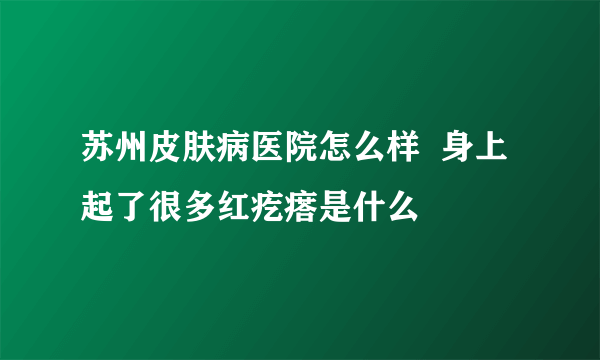 苏州皮肤病医院怎么样  身上起了很多红疙瘩是什么