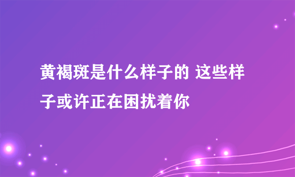 黄褐斑是什么样子的 这些样子或许正在困扰着你